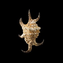 chiragra arthritica 4